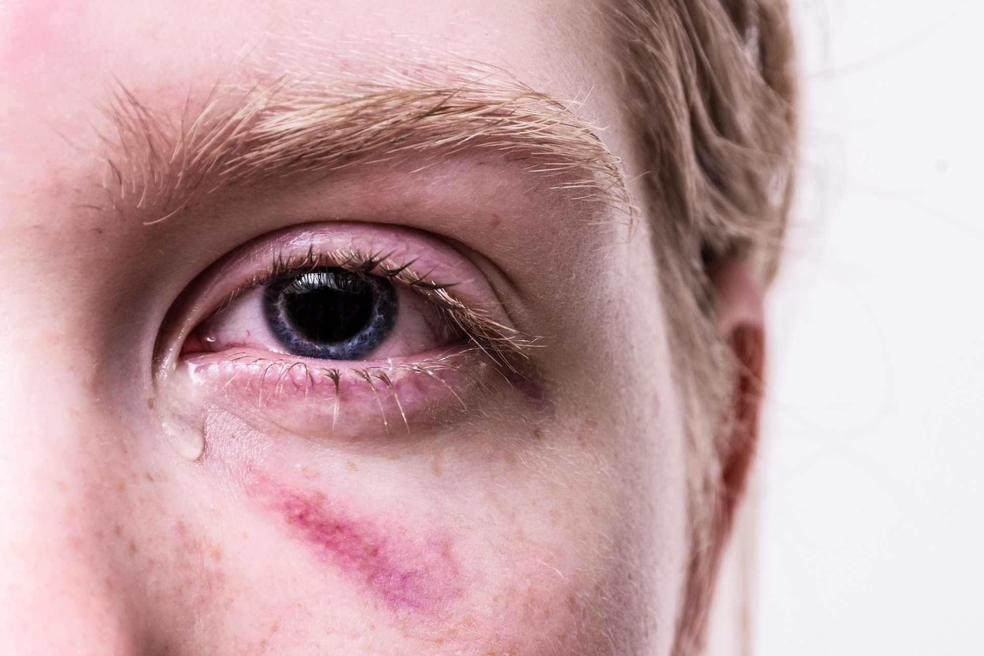 Poranění očí a jak jim zabránit