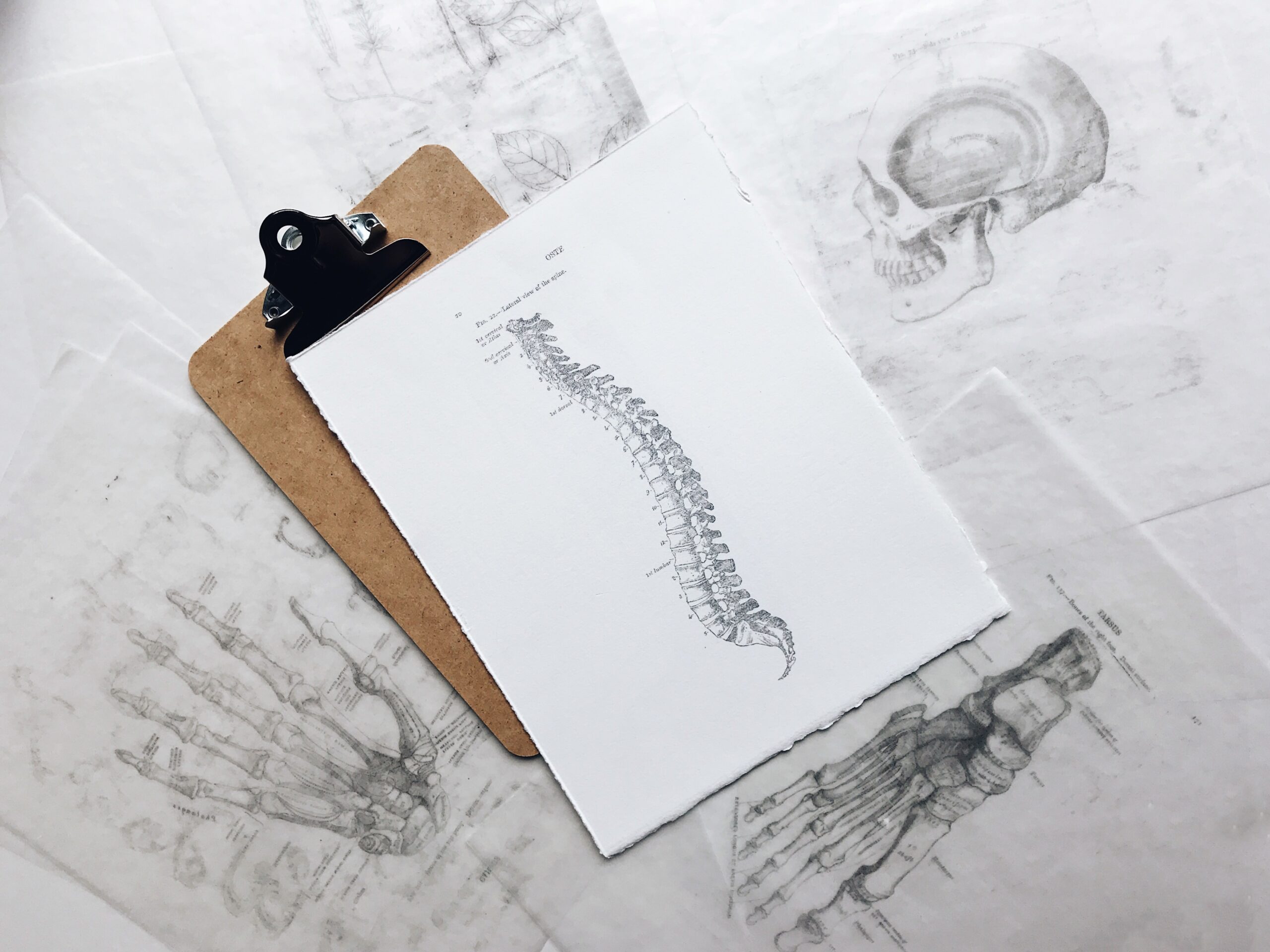 muskuloskeletální poruchy